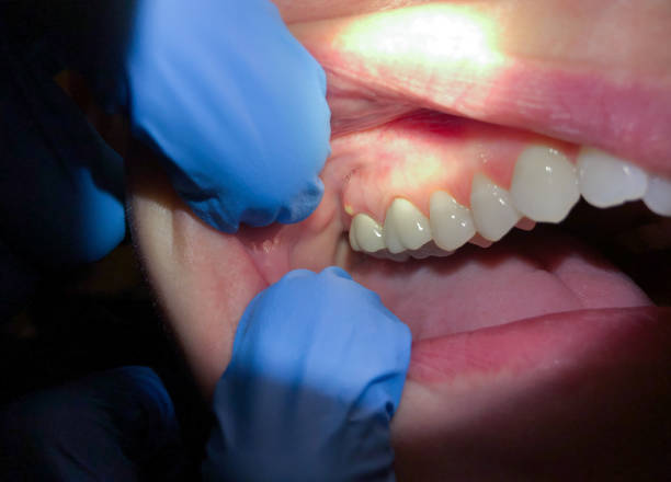 Best Broken or Cracked Tooth Emergency Dentist in Beloit, OH