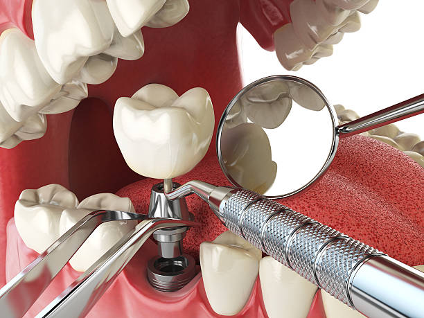 Best Emergency Dentist for Knocked-Out Tooth in Beloit, OH